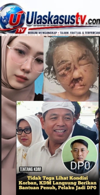 Gubernur Dedi Mulyadi Jenguk Korban Kekerasan di RSHS, Pemprov Jabar Tanggung Seluruh Biaya Pengobatan